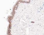 TROP2 Antibody in Immunohistochemistry (Paraffin) (IHC (P))