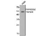 TMPRSS2 Monoclonal Antibody (A6D9)