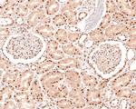 NCoR1 Antibody in Immunohistochemistry (Paraffin) (IHC (P))