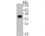 ABHD3 Monoclonal Antibody (A5D4)