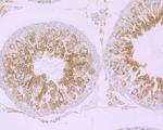 Cullin 2 Antibody in Immunohistochemistry (Paraffin) (IHC (P))