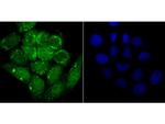 alpha Synuclein Recombinant Rabbit Monoclonal Antibody (JB42-33)