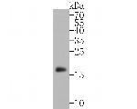 alpha Synuclein Antibody in Western Blot (WB)