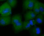 CCL5 (RANTES) Recombinant Rabbit Monoclonal Antibody (JM03-45)