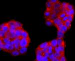FOXP3 Antibody in Immunocytochemistry (ICC/IF)