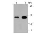 GPX1 Recombinant Rabbit Monoclonal Antibody (JJ092-07)