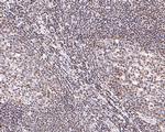 STAT4 Antibody in Immunohistochemistry (Paraffin) (IHC (P))