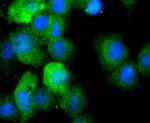 IL-1 beta Recombinant Rabbit Monoclonal Antibody (JJ087-3)