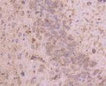 Tyrosine Hydroxylase Antibody in Immunohistochemistry (Paraffin) (IHC (P))