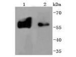 Tyrosine Hydroxylase Antibody in Western Blot (WB)