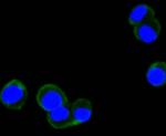 Phospho-FAK (Tyr397) Antibody in Immunocytochemistry (ICC/IF)