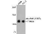 Phospho-FAK (Tyr397) Antibody in Western Blot (WB)