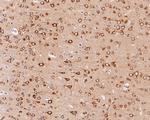 Phospho-Tau-F (Thr231) Antibody in Immunohistochemistry (Paraffin) (IHC (P))