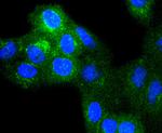beta-2 Microglobulin Antibody in Immunocytochemistry (ICC/IF)