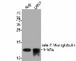 beta-2 Microglobulin Antibody in Western Blot (WB)