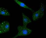 STAT6 Recombinant Rabbit Monoclonal Antibody (SY02-72)