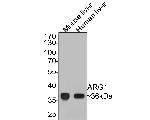Arginase 1 Recombinant Rabbit Monoclonal Antibody (SY09-06)