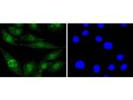 EGFR Recombinant Rabbit Monoclonal Antibody (SP00-86)