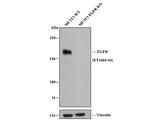 EGFR Antibody in Western Blot (WB)