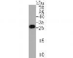 GFP Recombinant Rabbit Monoclonal Antibody (SP069-0)