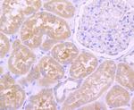 EGFR Antibody in Immunohistochemistry (Paraffin) (IHC (P))