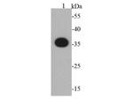 S tag Monoclonal Antibody (G10-C8)