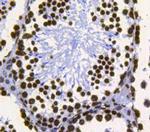 Histone H3 Antibody in Immunohistochemistry (Paraffin) (IHC (P))