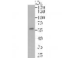 FOXA1 Monoclonal Antibody (A2E8)