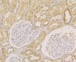 APE1 Antibody in Immunohistochemistry (Paraffin) (IHC (P))