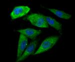 IL-6 Antibody in Immunocytochemistry (ICC/IF)