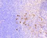 OX40 (CD134) Antibody in Immunohistochemistry (Paraffin) (IHC (P))