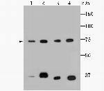 HSPA9 Monoclonal Antibody (6-A9)