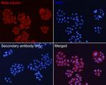 beta Tubulin Antibody in Immunocytochemistry (ICC/IF)