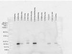 CRYAB Antibody in Western Blot (WB)