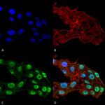 DNMT1 Antibody in Immunocytochemistry (ICC/IF)