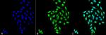 PP5 Monoclonal Antibody (12F7), FITC