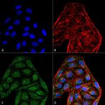 CD74 Antibody in Immunocytochemistry (ICC/IF)