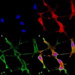 SHANK1 Monoclonal Antibody (N22/21), FITC