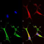 ATP7B Antibody in Immunocytochemistry (ICC/IF)