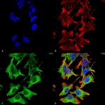 NMDAR1 Monoclonal Antibody (N308/48), FITC