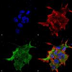 NALCN Monoclonal Antibody (N187/7), PE