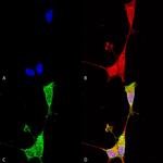 Brevican Antibody in Immunocytochemistry (ICC/IF)