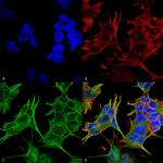 NMDAR2A Monoclonal Antibody (N327/95), APC