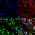 NMDAR2A Antibody in Immunocytochemistry (ICC/IF)