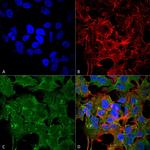 NMDAR2A Antibody in Immunocytochemistry (ICC/IF)