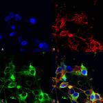 AMIGO1 Antibody in Immunocytochemistry (ICC/IF)