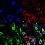 Versican Antibody in Immunocytochemistry (ICC/IF)