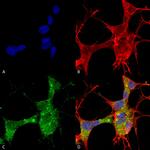GFAP Antibody in Immunocytochemistry (ICC/IF)