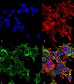 GFAP Antibody in Immunocytochemistry (ICC/IF)