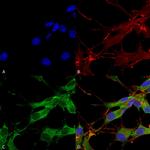 LRRK2 Antibody in Immunocytochemistry (ICC/IF)